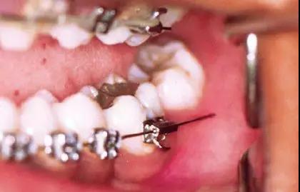 微信图片_20200210130932