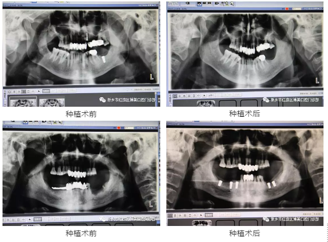 QQ截图20190404155958